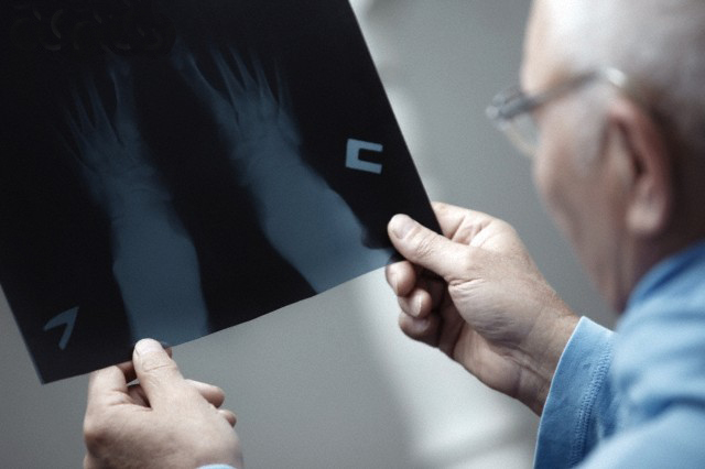 Senior doctor holding and testing X-ray photograph --- Image by © Arman Zhenikeyev/Corbis